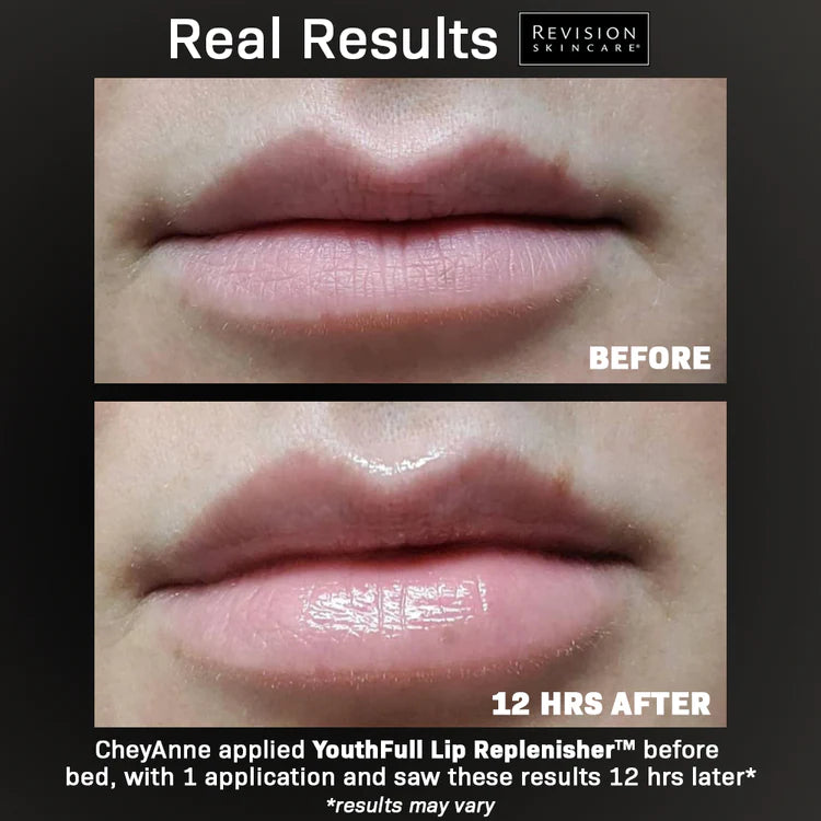 Youthful Lip Replenisher Revision before and after